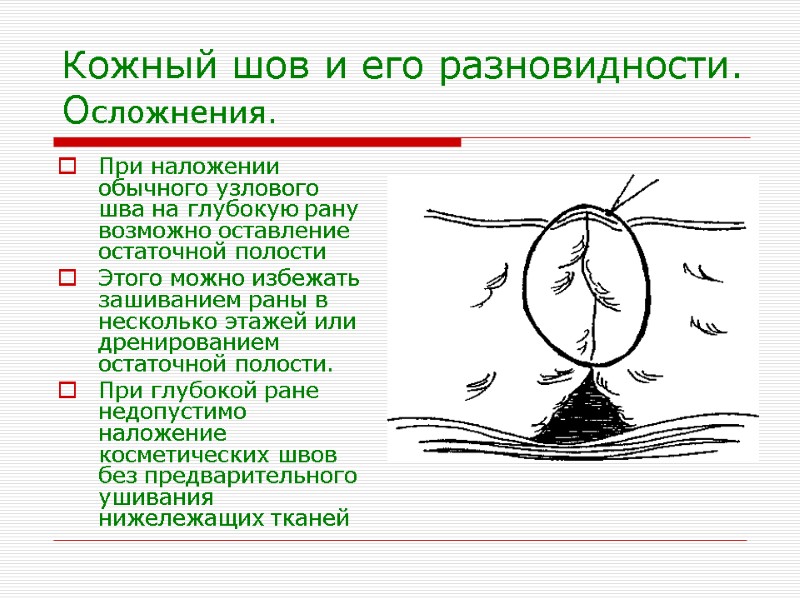 Кожный шов и его разновидности. Осложнения. При наложении обычного узлового шва на глубокую рану